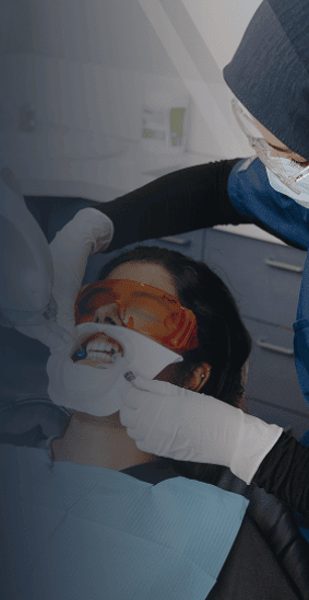 teeth whitening offer min